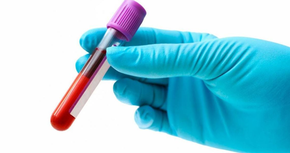 Chỉ số HCT trong xét nghiệm máu là gì? Thế nào là cao, thấp, bình thường?