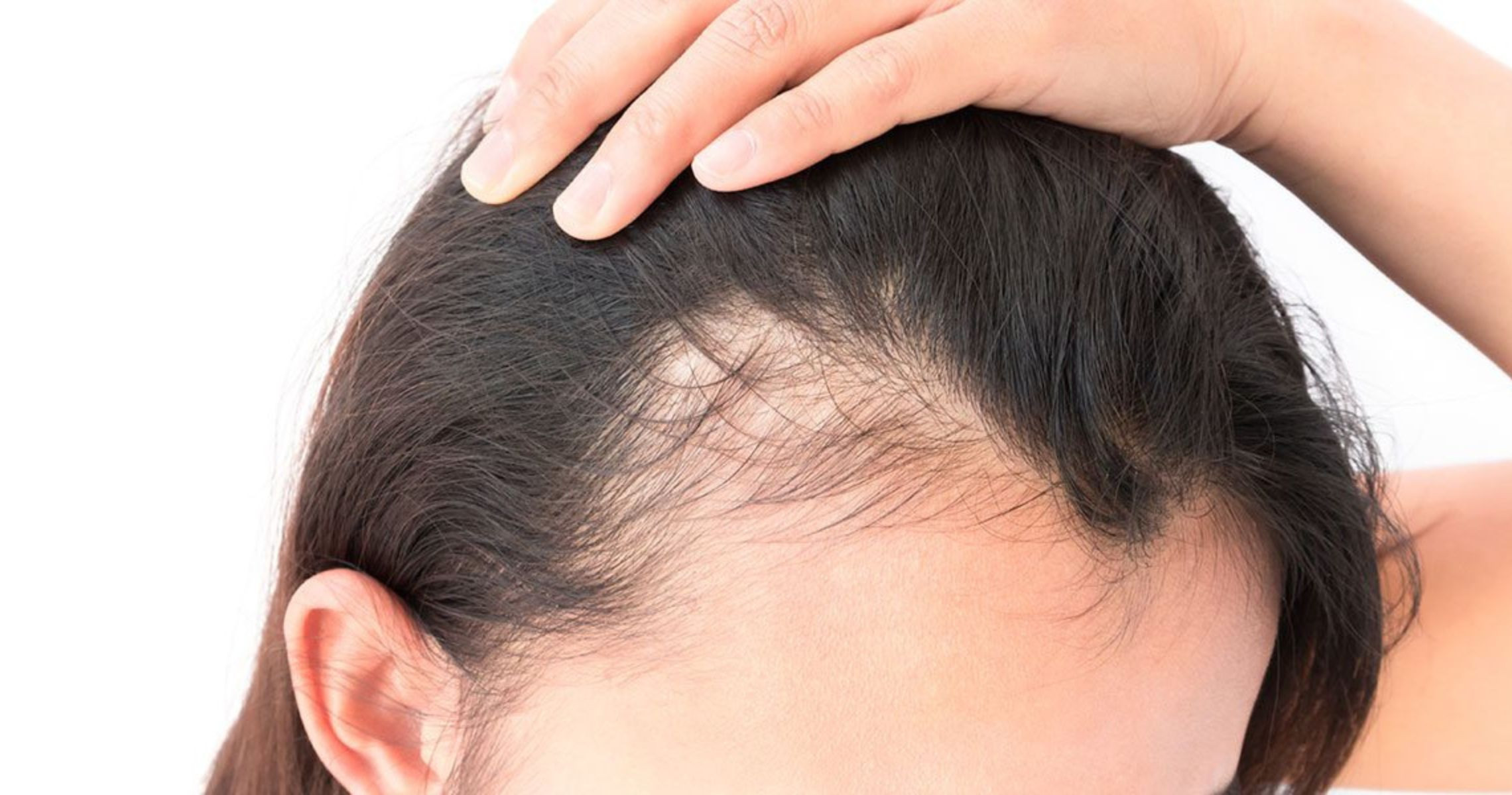 Cách kích thích tóc mọc nhiều cho người bị hói, rụng tóc