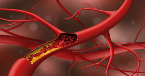 Người bị Cholesterol cao nên ăn gì?