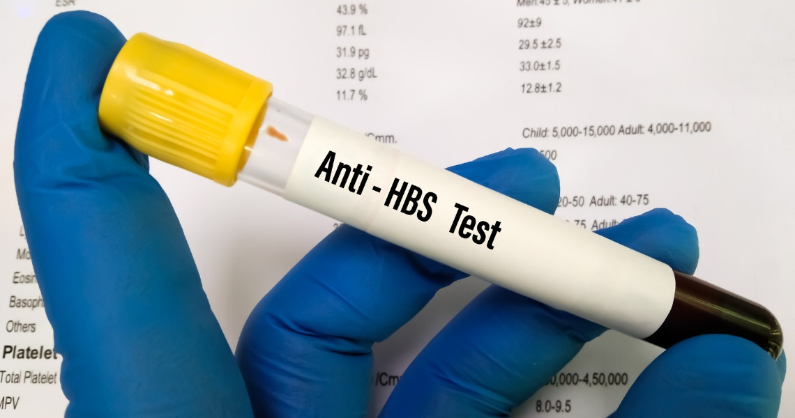 Anti HBs trong xét nghiệm máu là gì?