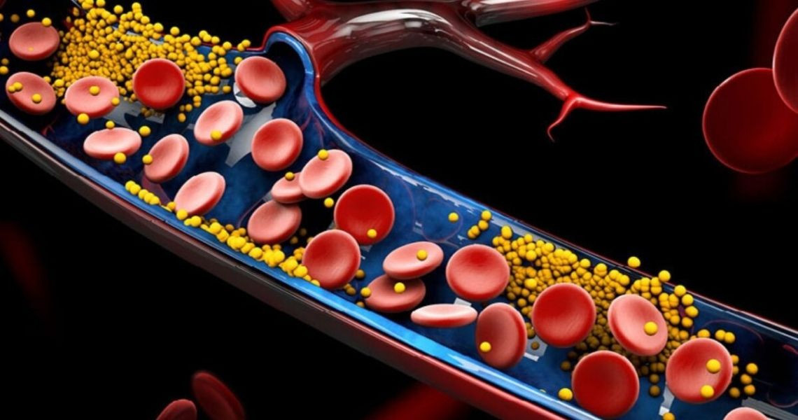 Cách quản lý mức Cholesterol hiệu quả