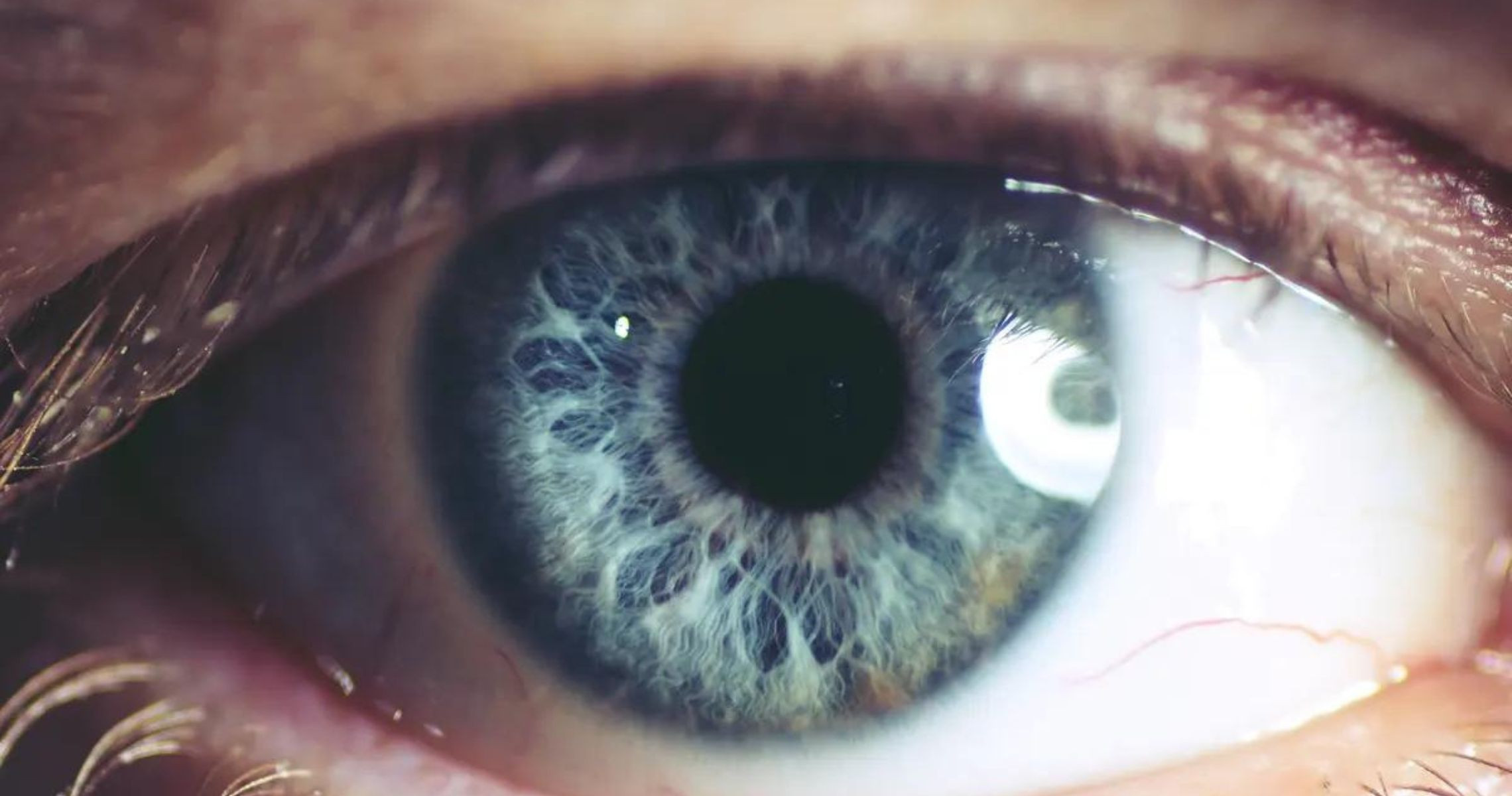 Các yếu tố nguy cơ gây thoái hóa điểm vàng ở mắt