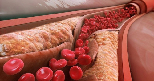 Cholesterol được sản xuất thế nào trong cơ thể bạn?