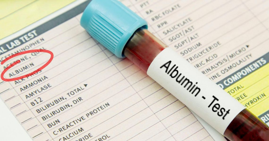 Chỉ số xét nghiệm albumin máu thế nào là bình thường?