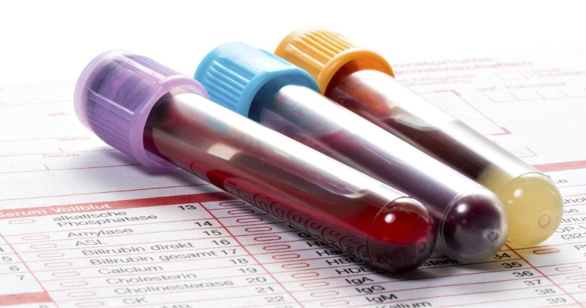 Kết quả xét nghiệm máu bạch cầu tăng có nghĩa là gì?