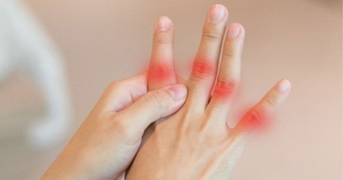Cách giảm đau khớp ngón tay