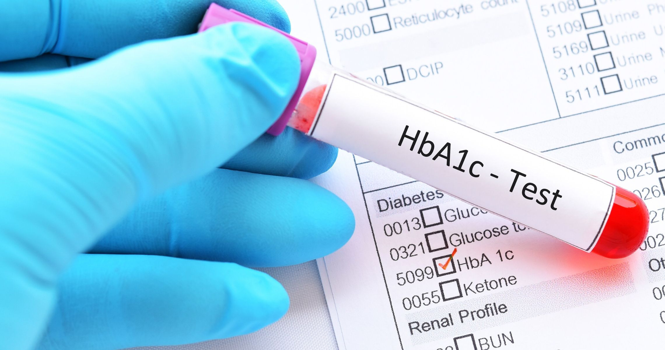 Chỉ số HbA1c 7.2 có phải mắc bệnh đái tháo đường?